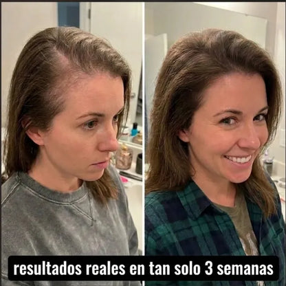 Regenerador Capilar