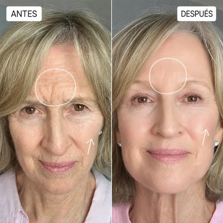 Microescultura Facial Líquida