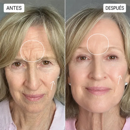 Microescultura Facial Líquida
