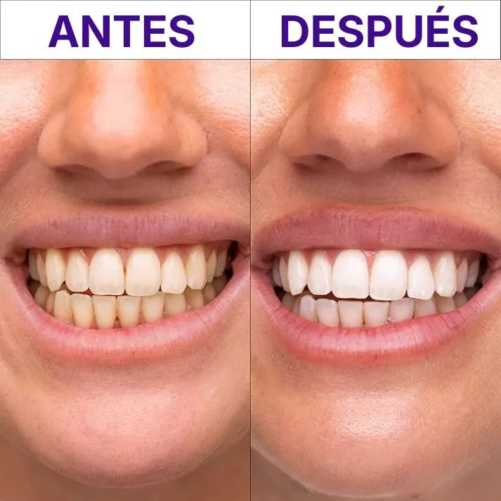 Hismile