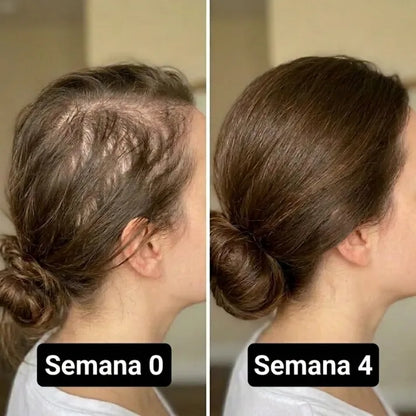 Regenerador Capilar