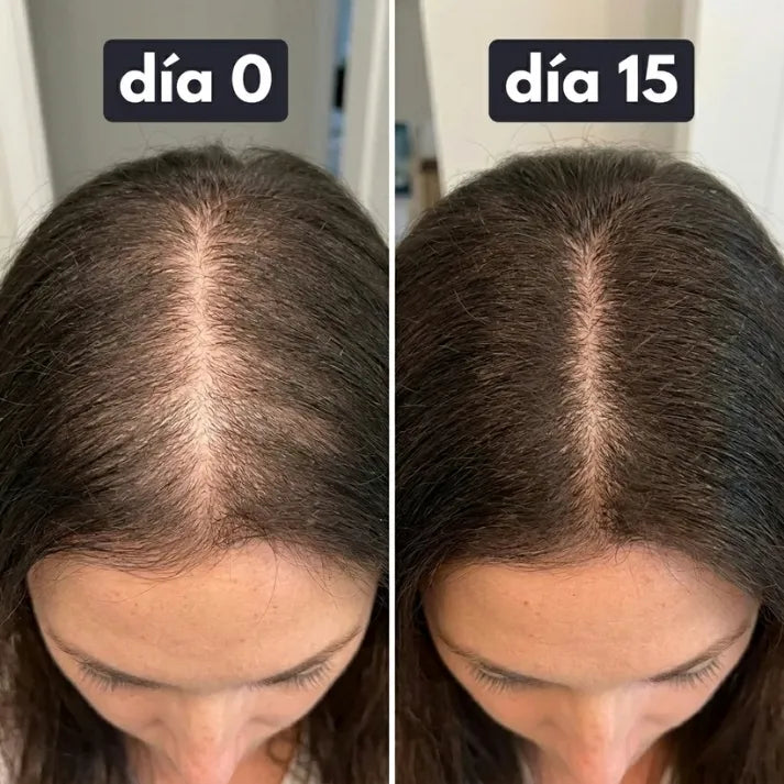 Regenerador Capilar